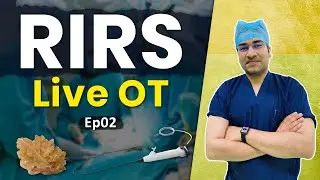 Kidney Stone Treatment | rirs | Fans rirs | LIVE OT | How rirs is done