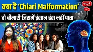 What is Chiari Malformation? | The Rare Brain Disease That Stops People from Laughing |Sanskriti IAS