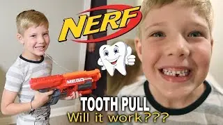 Crazy NERF Gun Tooth Pull Attempt! Cohen's First Loose TOOTH!!