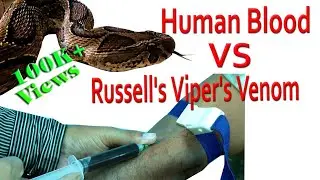Russell's Viper Venom Effects On Human Blood