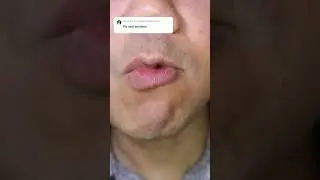 @Doctor Tristan Peh#long #asm...ASMRI mini Snickers Chocolate #ASMR #Shorts #Snickers  #Chocolate