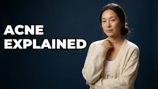 How Does Acne Develop On Your Face?