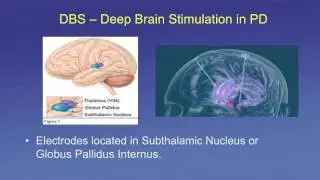 Understanding PD In Depth View