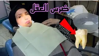 خلعت ضرس 🦷 العقل،اغمي عليا!!! غزل بكت؟