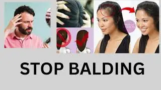 Strong and Healthy Hairgrowth with Soapnuts#