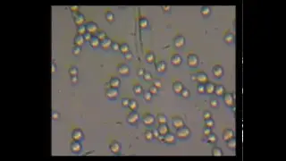 Microscope cells: Brewer's yeast (Saccharomyces Cerevisiae)