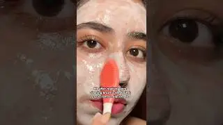 Easiest way to remove blackheads and whiteheads permanently 💯✨