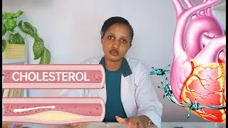 Cholesterol ni iki? | Ibituma Cholesterol yiyongera mu Mubiri | Ibiribwa bigabanya Cholesterol