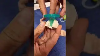 #dentist #dental #dentaltok #parenting  #pacifier #pacifierproblems #pacifierwea