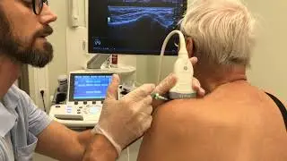 Ultrasoundguided AC-joint injection