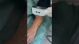 #Professional IPL Elight Hair Removal Skin Rejuvenation Beauty Machine for Clinic