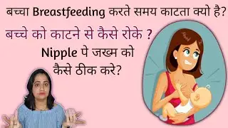 स्तनपान के समय शिशु काटता है तो क्या करे ? | How to stop baby biting during breastfeeding?