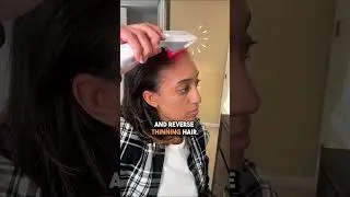 Actonis by Hairmax Dual Action: LaserComb & Supplements for Female Hair Loss