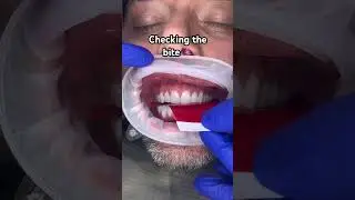 Checking the bite 🫦 #dentalasmr #asmr #asmrmouthsounds #dentalveneers #cosmeticdentistry