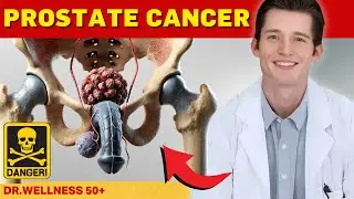Warning: 7 Early Signs of Prostate Cancer That Are Often Overlooked