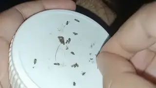 Asmr lots of giant lice picking from cousin'sling hair #licepicking #asmrnitpicking #asmrhairpulling