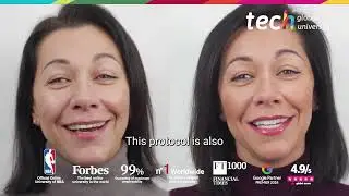 Retention with Aligners After Invisible Orthodontics ❘ TECH Global University