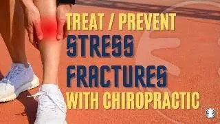 How Chiropractors Help Prevent and Treat Stress Fractures