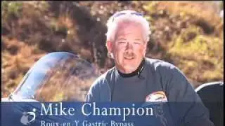 Mike Champion's Roux-en-Y Gastric Bypass Testimonial