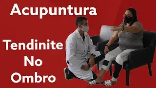 Acupuntura para Tendinite no Ombro