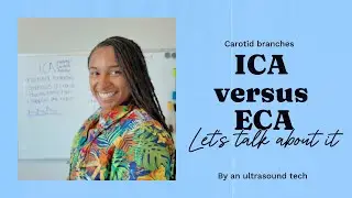 ICA vs ECA | Carotid Branches | Ultrasound Tech #carotid #arteries