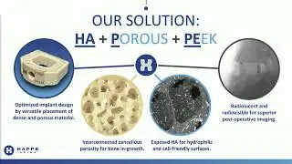 HAPPE Spine: The Implant That Heals Like Bone | MedTech World Bay Area 2025