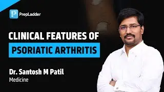 Clinical Features of Psoriatic Arthritis by Dr. Santosh M Patil