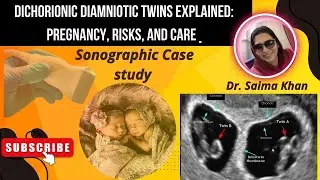 Dichorionic Diamniotic Twins Explained: Pregnancy, Risks, and Care @Dr.Saimakhan