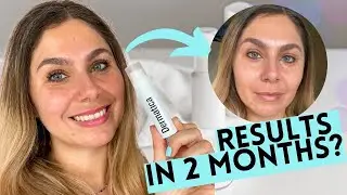 60 days of DERMATICA for my ROSACEA | REVIEW | thelidiaedit
