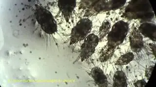 Under Microscope: Flour Mites Acarus siro (Acarina, Acaridae) Kiev, Ukraine