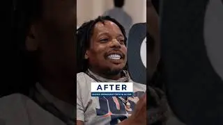 Is This The Craziest Dental Implant Transformation?? 🤔 Permanent Teeth in 24 HOURS 🤯🫢 #shorts