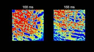 ICC Tissue Models.wmv