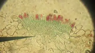 ScienceVerse | Biolog&iacute;a | Puccinia graminis con lofi