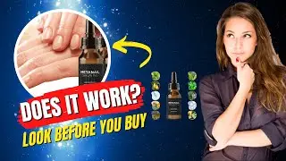 Does Metanail Complex work? Is Metanail Complex Worth It? Metanail Complex Where To Buy?