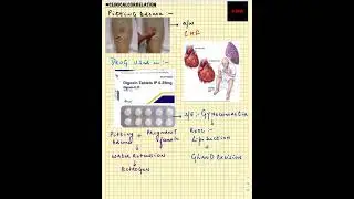 #Shorts | Clinical Correlation | NEET/NEXT PG/FMGE/MBBS | Pitting Edema | CHF | GYNECOMASTIA