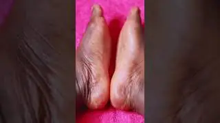 Foot Peel Mask removed dead skin. Review by @allthingsanto