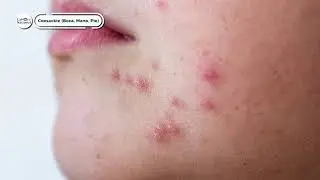 Entrevista al Dr. Rodolfo Norberto Jiménez Juárez sobre el virus Coxsackie.