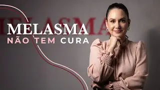 Melasma n&atilde;o tem cura