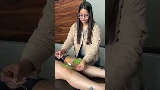 Guess the therapy !! #bnys #naturopathy #massage #kneepainrelief #acupuncture #relaxation #pain