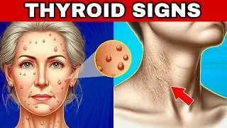 🚨 8 THYROID WARNING SIGNS (Hypothyroidism and Hyperthyroidism)