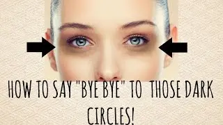 HOW TO GET RID OF DARK CIRCLES?     |SolutionsRoom|