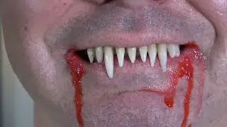 Custom-Made Vampire Fangs: Professional Process Explained