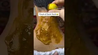 How To Remove Dirt From Neck|Easy Neck Cleaning Tips,Remove Suntan #hacks #shorts #beauty #suntan