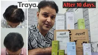 Traya hair treatment review. Part 3