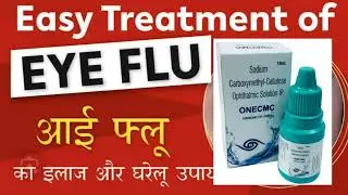 Eye Flu में घरेलु इलाज बिलकुल नहीं करे || Eyeflu treatment || Optometry solution
