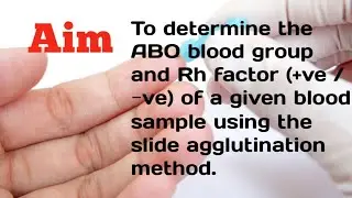 ABO Blood Group testing (Rh factors) 