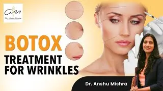 Botox Treatment Explained | Botox Treatment for Wrinkles | Do's and Don'ts After Botox