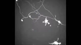 Brain cells forming new connections!