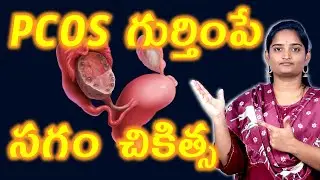 PCOS గుర్తింపే చికిత్స | PCOS Signs Tests Best Ovarian Cysts Homeopathy Treatment Cure | Arogyam Max