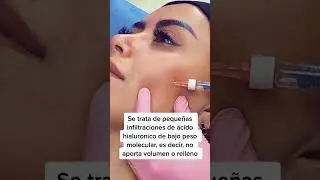 #skinbooster para mejorar la calidad de la #piel